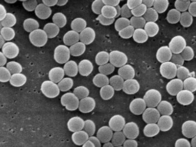 Обнаружена "супербактерия", устойчивая ко всем антибиотикам