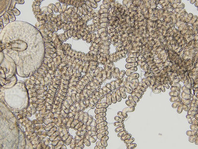 Биологи разрешили "парадокс большой спермы" дрозофил