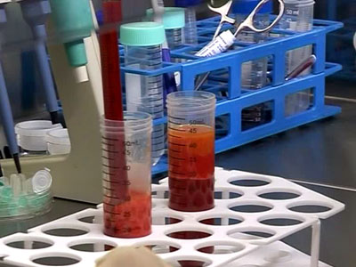 Лечение Слуха Казань